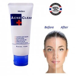 Mistine Acne Clear Facial Foam Face Wash 85 Gm